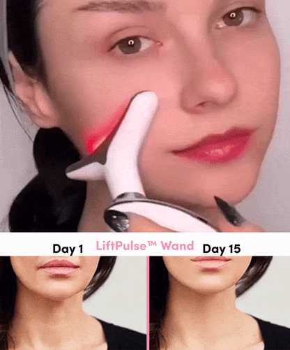 Seluna™ Face Lift Device